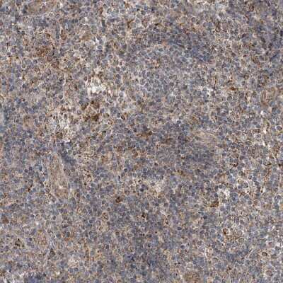 Immunohistochemistry-Paraffin: SAMD3 Antibody [NBP1-88731] - Staining of human tonsil shows moderate to strong granular cytoplasmic positivity in non-germinal center cells.