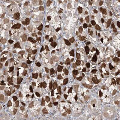 Immunohistochemistry-Paraffin: SAMD3 Antibody [NBP1-88732] - Staining of human stomach shows strong cytoplasmic positivity in glandular cells.