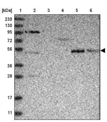 Western Blot: SAMD3 Antibody [NBP1-88731] - Lane 1: Marker  [kDa] 230, 130, 95, 72, 56, 36, 28, 17, 11.  Lane 2: Human cell line RT-4.  Lane 3: Human cell line U-251MG sp.  Lane 4: Human plasma (IgG/HSA depleted).  Lane 5: Human liver tissue.  Lane 6: Human tonsil tissue