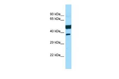 Western Blot: SAMD3 Antibody [NBP2-85686] - WB Suggested Anti-SAMD3 Antibody. Titration: 1.0 ug/ml. Positive Control: Hela Whole Cell