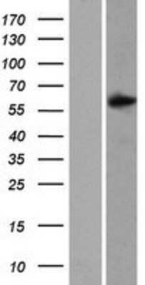 Western Blot: SAMD3 Overexpression Lysate (Adult Normal) [NBP2-08682] Left-Empty vector transfected control cell lysate (HEK293 cell lysate); Right -Over-expression Lysate for SAMD3.