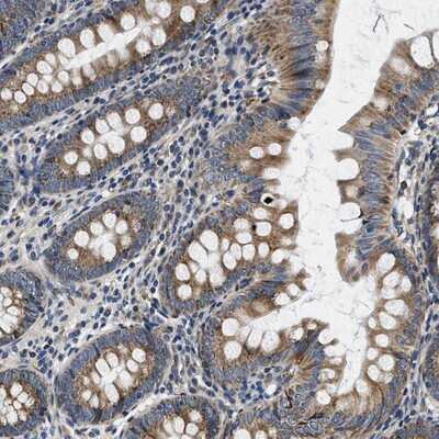 Immunohistochemistry-Paraffin: SAMD4B Antibody [NBP1-94045] - Staining of human appendix shows cytoplasmic positivity in glandular cells.