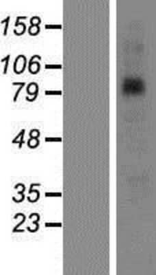 Western Blot: SAMD4B Overexpression Lysate (Adult Normal) [NBP2-06883] Left-Empty vector transfected control cell lysate (HEK293 cell lysate); Right -Over-expression Lysate for SAMD4B.
