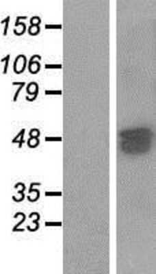 Western Blot: SAMD7 Overexpression Lysate (Adult Normal) [NBP2-04836] Left-Empty vector transfected control cell lysate (HEK293 cell lysate); Right -Over-expression Lysate for SAMD7.