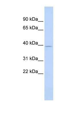 Western Blot: SAMD8 Antibody [NBP1-60113] - Titration: 0.2-1 ug/ml, Positive Control: Human heart.