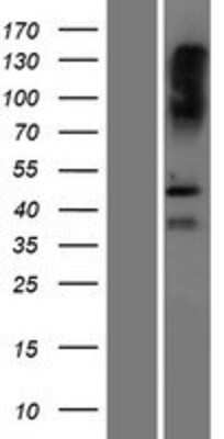 Western Blot: SAMD8 Overexpression Lysate (Adult Normal) [NBP2-10253] Left-Empty vector transfected control cell lysate (HEK293 cell lysate); Right -Over-expression Lysate for SAMD8.