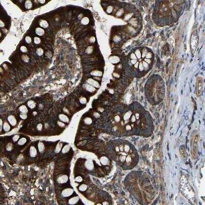 Immunohistochemistry: SAMD9L Antibody [NBP1-91243] - Staining of human small intestine shows strong cytoplasmic positivity in glandular cells.