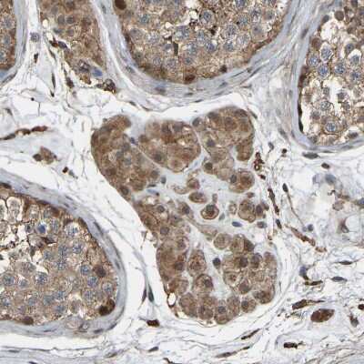 Immunohistochemistry-Paraffin: SAMD9L Antibody [NBP1-91241] - Staining of human testis shows moderate cytoplasmic positivity in Leydig cells.