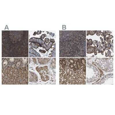 Immunohistochemistry-Paraffin: SAMD9L Antibody [NBP1-91241] - Staining of human lymph node, placenta, stomach and testis using Anti-SAMD9L antibody NBP1-91241 (A) shows similar protein distribution across tissues to independent antibody NBP1-91242 (B).