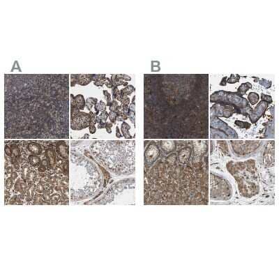 <b>Independent Antibodies Validation. </b>Immunohistochemistry-Paraffin: SAMD9L Antibody [NBP1-91242] - Staining of human lymph node, placenta, stomach and testis using Anti-SAMD9L antibody NBP1-91242 (A) shows similar protein distribution across tissues to independent antibody NBP1-91241 (B).