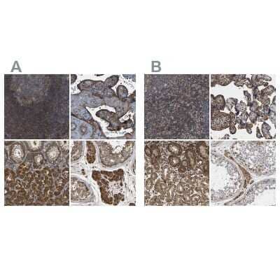 <b>Independent Antibodies Validation. </b>Immunohistochemistry-Paraffin: SAMD9L Antibody [NBP1-91243] - Staining of human lymph node, placenta, stomach and testis using Anti-SAMD9L antibody NBP1-91243 (A) shows similar protein distribution across tissues to independent antibody NBP1-91242 (B).