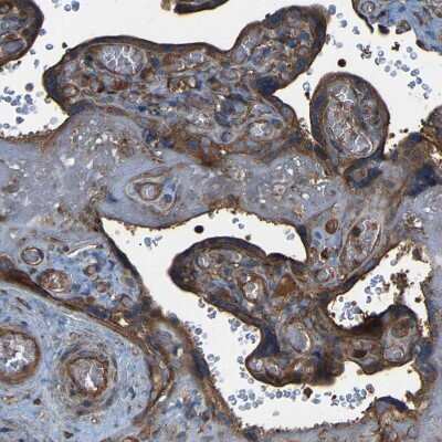 Immunohistochemistry-Paraffin: SAMD9L Antibody [NBP1-91243] - Staining of human placenta shows strong granular cytoplasmic positivity in trophoblastic cells.