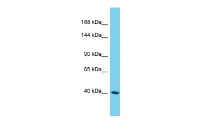 Western Blot: SAMD9L Antibody [NBP2-88209] - Host: Rabbit. Target Name: SAMD9L. Sample Type: HepG2 Whole Cell lysates. Antibody Dilution: 1.0ug/ml