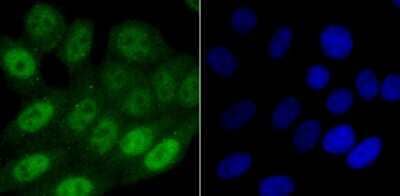 Immunocytochemistry/Immunofluorescence: SAMHD1 Antibody (JU56-04) [NBP2-75655] - Staining SAMHD1 in HepG2 cells (green). The nuclear counter stain is DAPI (blue). Cells were fixed in paraformaldehyde, permeabilised with 0.25% Triton X100/PBS.