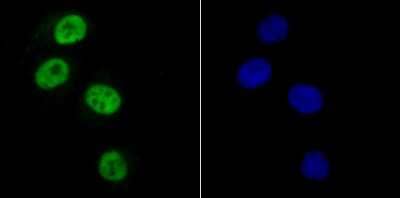 Immunocytochemistry/Immunofluorescence: SAMHD1 Antibody (JU56-04) [NBP2-75655] - Staining SAMHD1 in HUVEC cells (green). The nuclear counter stain is DAPI (blue). Cells were fixed in paraformaldehyde, permeabilised with 0.25% Triton X100/PBS.