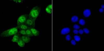 Immunocytochemistry/Immunofluorescence: SAMHD1 Antibody (JU56-04) [NBP2-75655] - Staining SAMHD1 in LOVO cells (green). The nuclear counter stain is DAPI (blue). Cells were fixed in paraformaldehyde, permeabilised with 0.25% Triton X100/PBS.