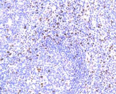 Immunohistochemistry-Paraffin: SAMHD1 Antibody (JU56-04) [NBP2-75655] - Analysis of paraffin-embedded human tonsil tissue using anti-SAMHD1 antibody. Counter stained with hematoxylin.
