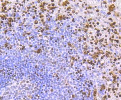 Immunohistochemistry-Paraffin: SAMHD1 Antibody (JU56-04) [NBP2-75655] - Analysis of paraffin-embedded human spleen tissue using anti-SAMHD1 antibody. Counter stained with hematoxylin.