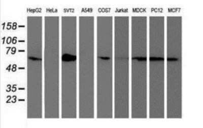 Western Blot: SAMHD1 Antibody (OTI3F5) - Azide and BSA Free [NBP2-73979] - Analysis of extracts (35ug) from 9 different cell lines by using anti-SAMHD1 monoclonal antibody.