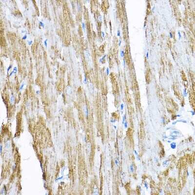 Immunohistochemistry-Paraffin: SAMM50 Antibody [NBP2-94852] - Immunohistochemistry of paraffin-embedded rat heart using SAMM50 Rabbit pAb (NBP2-94852) at dilution of 1:200 (40x lens). Perform high pressure antigen retrieval with 10 mM citrate buffer pH 6.0 before commencing with IHC staining protocol.