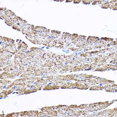 Immunohistochemistry-Paraffin: SAMM50 Antibody [NBP2-94852] - Immunohistochemistry of paraffin-embedded mouse heart using SAMM50 Rabbit pAb (NBP2-94852) at dilution of 1:200 (40x lens). Perform high pressure antigen retrieval with 10 mM citrate buffer pH 6.0 before commencing with IHC staining protocol.