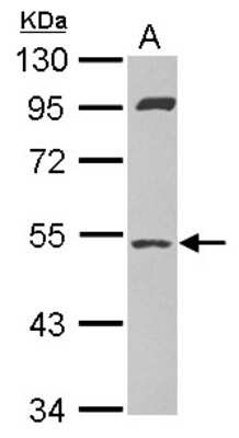 Western Blot: SAMM50 Antibody [NBP2-20257] - Sample (20 ug of whole cell lysate) A: A431 cytosol 10% SDS PAGE gel, diluted at 1:1000.