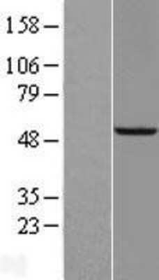 Western Blot: SAMM50 Overexpression Lysate (Adult Normal) [NBL1-15683] Left-Empty vector transfected control cell lysate (HEK293 cell lysate); Right -Over-expression Lysate for SAMM50.