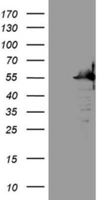 Western Blot: SAMSN1 Antibody (OTI7F5) - Azide and BSA Free [NBP2-73984] - Analysis of HEK293T cells were transfected with the pCMV6-ENTRY control (Left lane) or pCMV6-ENTRY SAMSN1 .