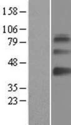 Western Blot: SAMSN1 Overexpression Lysate (Adult Normal) [NBL1-15684] Left-Empty vector transfected control cell lysate (HEK293 cell lysate); Right -Over-expression Lysate for SAMSN1.