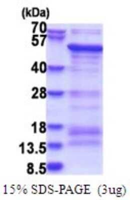 SDS-PAGE Recombinant Human SAMSN1 His Protein