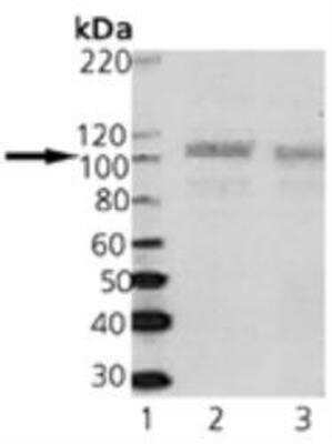 Western Blot: SAP102 Antibody (7D3) [NBP1-97467] - Analysis of SAP102: Lane 1: MW marker, Lane 2: Rat Nucleus Accumbens, Lane 3: Rat Nucleus Accumbens.