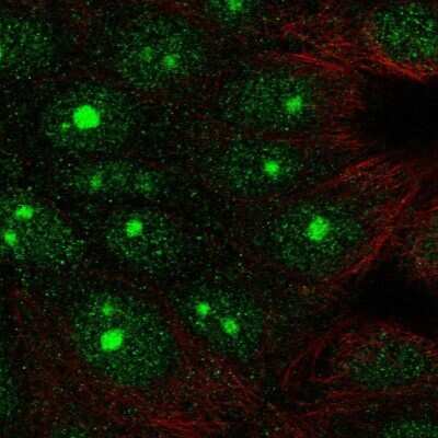 Immunocytochemistry/Immunofluorescence: SAP102 Antibody [NBP2-58864] - Staining of human cell line MCF7 shows localization to nucleus & nucleoli.