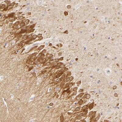 Immunohistochemistry-Paraffin: SAP102 Antibody [NBP1-87691] - Staining of human hippocampus shows strong cytoplasmic positivity in neurons.