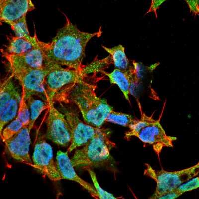 Immunocytochemistry/Immunofluorescence: SAP102 Antibody (S19-2) [NBP1-21672] - analysis using Mouse Anti-SAP102 Monoclonal Antibody, Clone S19-2 . Tissue: Neuroblastoma cell line SK-N-BE. Species: Human. Fixation: 4% Formaldehyde for 15 min at RT. Primary Antibody: Mouse Anti-SAP102 Monoclonal Antibody at 1:100 for 60 min at RT. Secondary Antibody: Goat Anti-Mouse ATTO 488 at 1:100 for 60 min at RT. Counterstain: Phalloidin Texas Red F-Actin stain; DAPI (blue) nuclear stain at 1:1000, 1:5000 for 60min RT, 5min RT. Localization: Cytoplasm . Magnification: 60X.