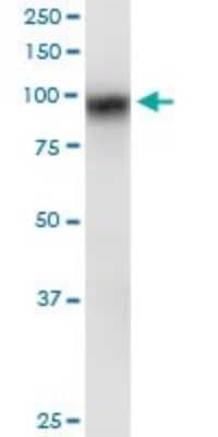Western Blot: SAP102 Antibody [H00001741-B01P] - Analysis of DLG3 expression in rat brain.