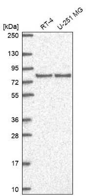 Western Blot: SAP102 Antibody [NBP2-58864] - Analysis in human cell line RT-4 and human cell line U-251 MG.