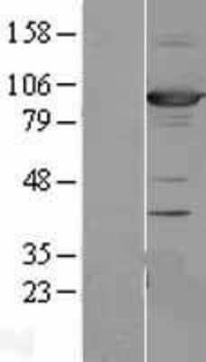 Western Blot: SAP102 Overexpression Lysate (Adult Normal) [NBL1-09910] Left-Empty vector transfected control cell lysate (HEK293 cell lysate); Right -Over-expression Lysate for SAP102.