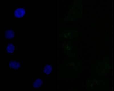 Immunocytochemistry/Immunofluorescence: SAP130 Antibody (JG63-53) [NBP2-76869] - ICC staining SF3B3 (green) in A549 cells. The nuclear counter stain is DAPI (blue). Cells were fixed in paraformaldehyde, permeabilised with 0.25% Triton X100/PBS.