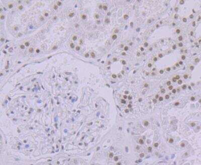 Immunohistochemistry: SAP130 Antibody (JG63-53) [NBP2-76869] - Immunohistochemical analysis of paraffin-embedded human kidney tissue using anti-SF3B3 antibody. Counter stained with hematoxylin.