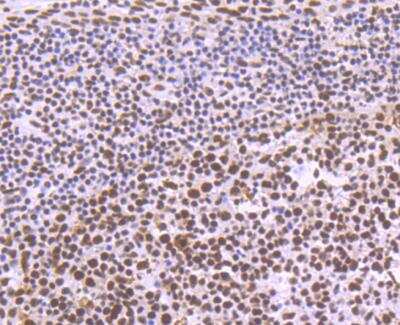 Immunohistochemistry: SAP130 Antibody (JG63-53) [NBP2-76869] - Immunohistochemical analysis of paraffin-embedded human tonsil tissue using anti-SF3B3 antibody. Counter stained with hematoxylin.