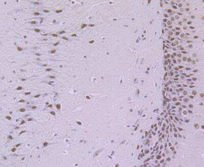 Immunohistochemistry: SAP130 Antibody (JG63-53) [NBP2-76869] - Immunohistochemical analysis of paraffin-embedded rat brain tissue using anti-SF3B3 antibody. Counter stained with hematoxylin.