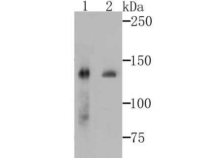 Western Blot: SAP130 Antibody (JG63-53) [NBP2-76869] - Western blot analysis of SF3B3 on Jurkat and Hela cells lysates using anti-SF3B3 antibody at 1/1,000 dilution.