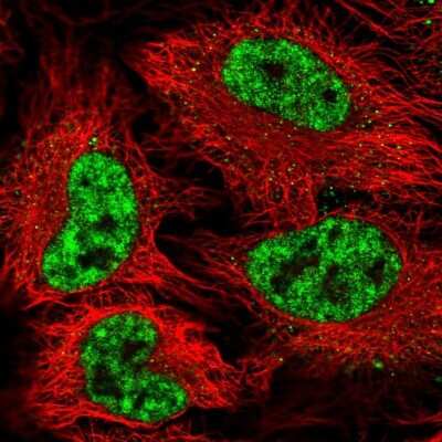 <b>Genetic Strategies Validation. </b>Immunocytochemistry/Immunofluorescence: SAP155 Antibody [NBP2-47291] - Immunofluorescent staining of human cell line HeLa shows localization to nuclear speckles.