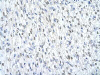 Immunohistochemistry: SAP155 Antibody [NBP1-57192] - Human cardiac cell Cellular data: Epithelial cells of renal tubule Antibody Concentration: 4.0-8.0 ug/ml Magnification: 400X.