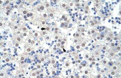 Immunohistochemistry-Paraffin: SAP155 Antibody [NBP1-57192] - Human Liver Tissue, antibody concentration 4-8ug/ml. Cells with positive label: Hepatocytes (indicated with arrows) 400X magnification.