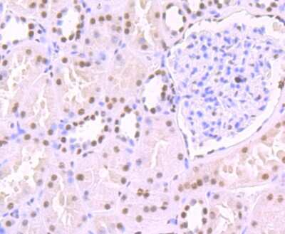 Immunohistochemistry-Paraffin: SAP155 Antibody (JB40-32) [NBP2-75656] - Analysis of paraffin-embedded human kidney tissue using anti-SF3B1 antibody. Counter stained with hematoxylin.