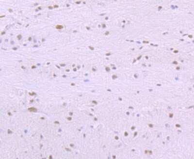 Immunohistochemistry-Paraffin: SAP155 Antibody (JB40-32) [NBP2-75656] - Analysis of paraffin-embedded rat brain tissue using anti-SF3B1 antibody. Counter stained with hematoxylin.