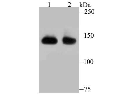 Western Blot: SAP155 Antibody (JB40-32) [NBP2-75656] - Analysis of SF3B1 on different lysates using anti-SF3B1 antibody at 1/500 dilution.Positive control:Lane 1: Mouse thymus            Lane 2: Hela