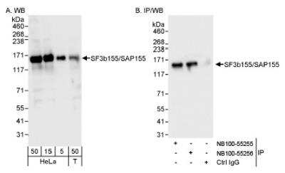 Western Blot: SAP155 Antibody [NB100-55255] - Detection of Human SF3b155/SAP155 on HeLa whole cell lysate using NB100-55255. SF3b155/SAP155 was also immunoprecipitated by rabbit anti-SF3b155/SAP155 antibody NB100-55256.