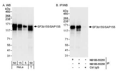 Western Blot: SAP155 Antibody [NB100-55256] - Detection of Human SF3b155/SAP155 on HeLa whole cell lysate (5, 15, and 50 microgram) and 293T cell lysate (50 microgram) using Nb100-55256. SF3b155/SAP155 was also immunoprecipitated by  rabbit anti-SF3b155/SAP155 antibody NB100-55255.